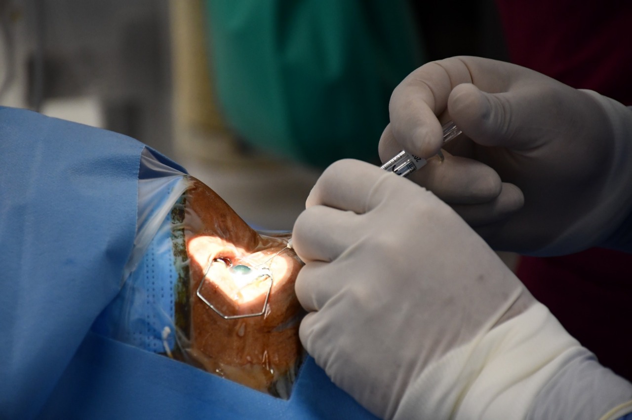 INVITA SECRETARÍA DE SALUD A CAMPAÑA DE CIRUGÍAS DE MÍNIMA INVASIÓN EN TLAXCALA