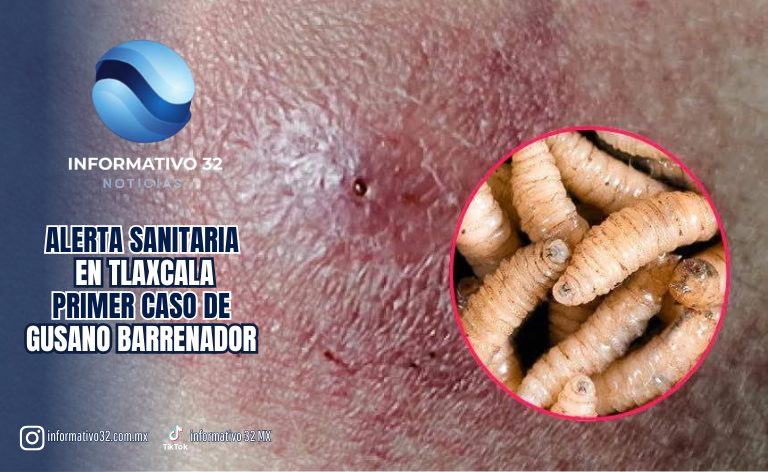 ¡ALERTA SANITARIA EN TLAXCALA! PIDEN EXTREMAR CUIDADOS TRAS DETECTARSE EL PRIMER CASO DE GUSANO BARRENADOR EN UNA PERSONA